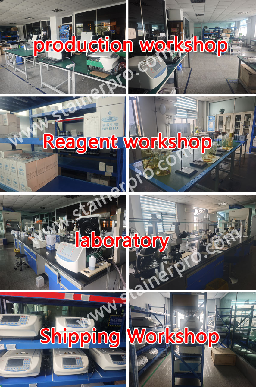 Chinese manufacturer of staining machine